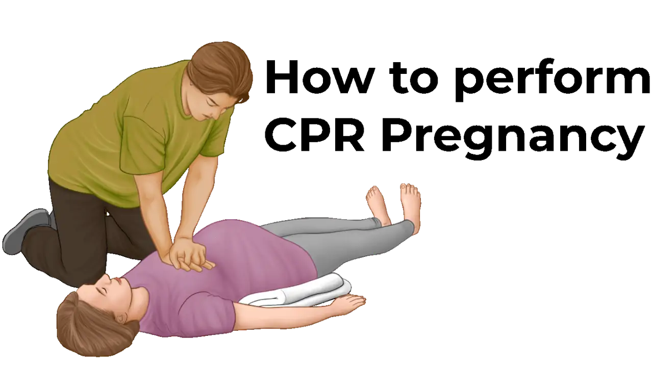 How to perform CPR Pregnancy